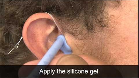 Taking Ear impressions