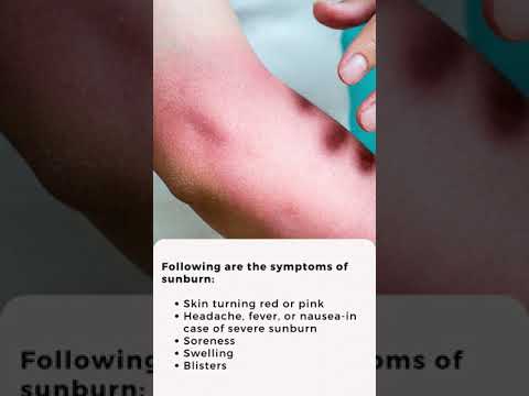 वीडियो: सनबर्न का इलाज कैसे करें (चित्रों के साथ)