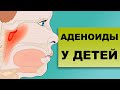 ПРИЧИНЫ АДЕНОИДОВ У ДЕТЕЙ