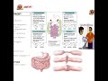 USMLE Step 1 Lecture Highlight – Large Intestine