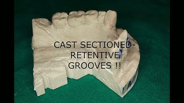 Altered Cast Technique (With Clinical case)