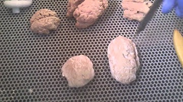 3D Brain from X-ray Computed Tomography, Cleaning