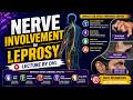 Nerve Hijack in Leprosy | Peripheral Nerve Involvement Explained | MD Dermatology