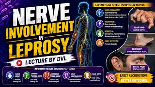 Nerve Hijack in Leprosy | Peripheral Nerve Involvement Explained | MD Dermatology
