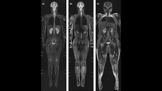 MRI Application training BRAIN MRI & TOTAL SPINE #Mri #Brain #pathology #technique #siemens