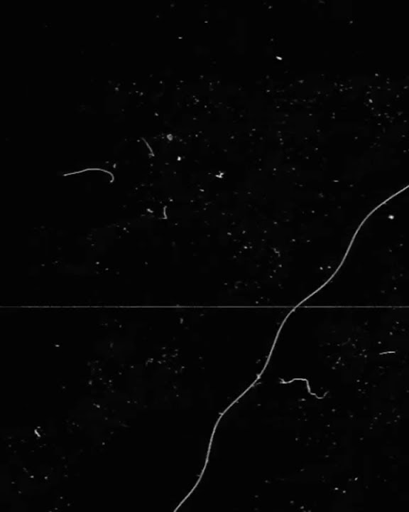 Glitch Effect | New Black Screen Glitch Effect | Glitch Effect Template Video
