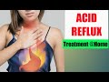 Heart Burn, Acids and Nyon'o  Treatment and Home remedies