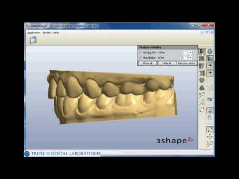 Ortho Viewer Views MP4