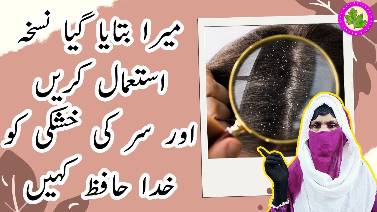 Easy Home Remedy For Hair Dandruff Treatment With Salt Sir Ke Khuskhe Ka Krain Khatma YouTube