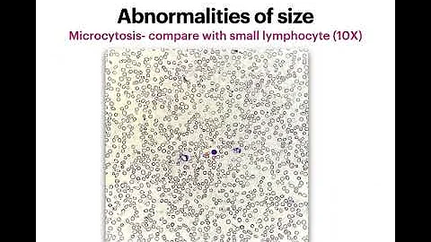 Pathlearnings Lecture series: Lecture 2 - RBC morphology Part 1