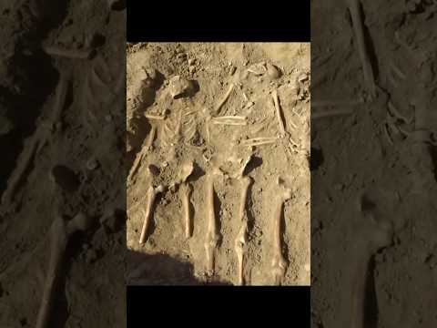 جندي ألماني مبتورة ساقاه استخراج رفات من الحرب العالمية الثانية