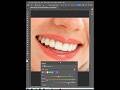 How to whiten teeth In Adobe Photoshop #photoshop #adobephoto #graphics #photoshoptutorial #drawing