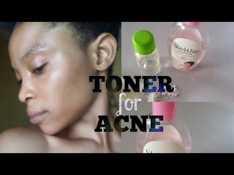 Toner | Acne Prone Skin