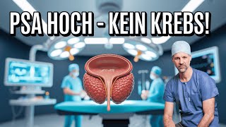 Erhöhter PSA-Wert? Ursachen OHNE Krebs!