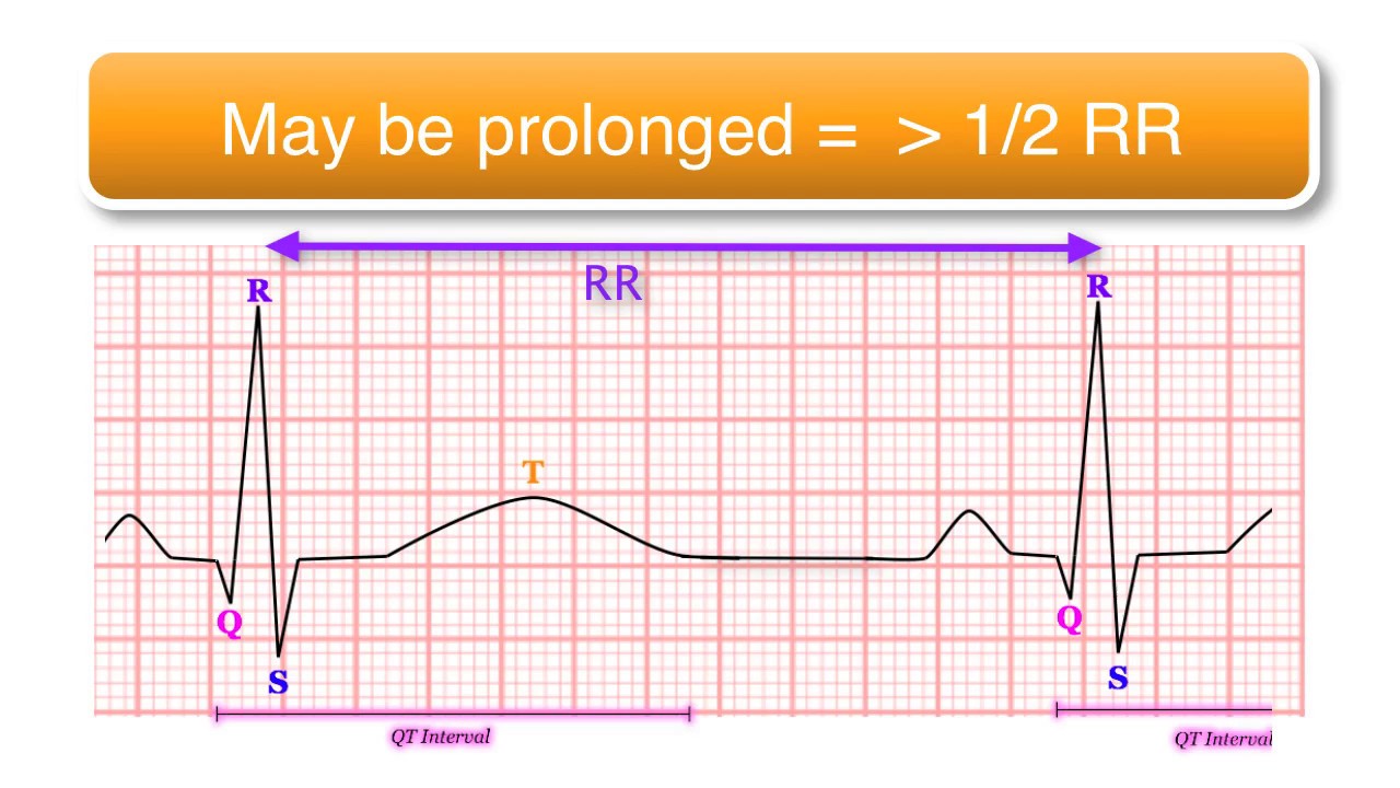 k-pie-zv-i-nezdrav-qtc-interval-calculation-rel-cii-pelmel-zlo-i-ko-aj