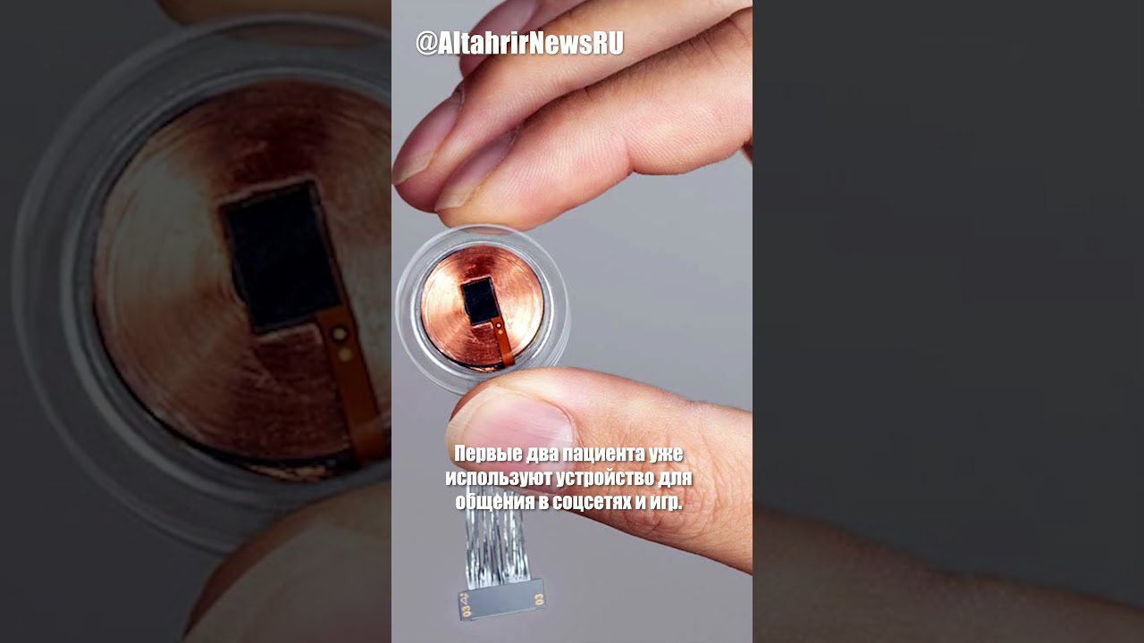 Третий пациент Neuralink управляет устройствами силой мысли