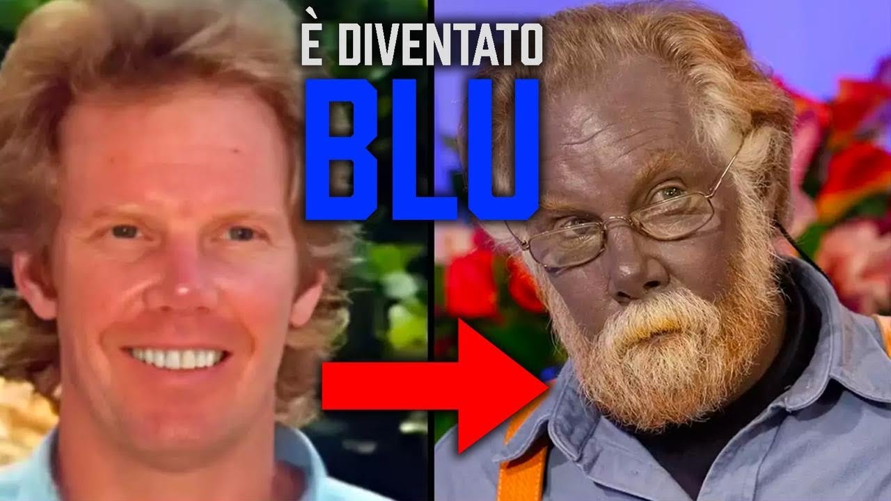 Paul Karason | L’Uomo Diventato BLU Per Sbaglio