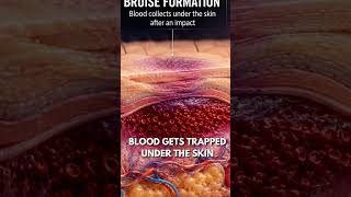 🟣🟢🟡 The Secret Behind Bruise Colors! #medicalfacts #bruises #facts #science #humanbody #viral