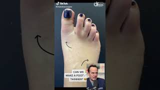 DOCTOR REACTS TO PLASTIC SURGERY ON THE FOOT!😱 #shorts #reaction