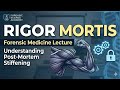 Rigor Mortis Fmt Early postmortem changes