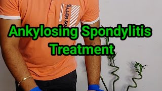 💥Ankylosing Spondylitis Treatment || Back Pain treatment ✅