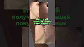 Аппарат дарсонваль BP-7000 с 5 насадками для ухода за лицом, телом и волосами (Biolift4 203)
