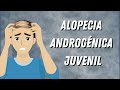 ALOPECIA ANDROGÉNICA JUVENIL // CÓMO EMPEZAR A TRATARLA