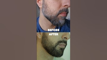 grey beard gone in minutes after using this