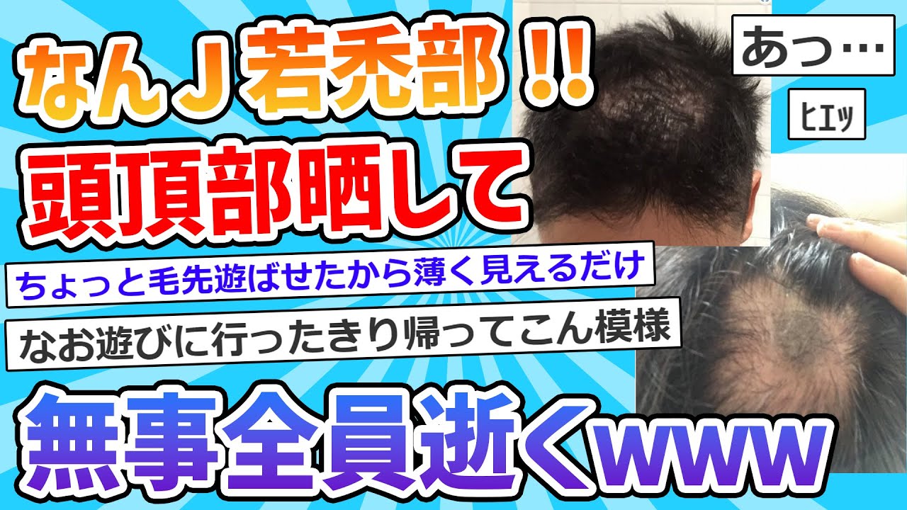 【2ch面白いスレ】床屋から「ちょっと薄くなってきてるかもしれません」と言われて写真撮ったから見てくれ