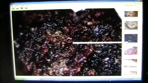 Mudfossil U part 9..creating feldspar and limestone