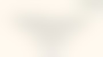 Robotic pyelolithotomy combined with flexible nephroscopic renal stone removal