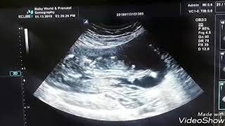 Baby boy 13 weeks