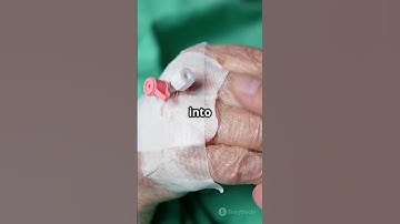 Floss Pick Could Replace Vaccine Shot! #VaccineInnovation #MedicalBreakthrough #FlossPickVaccine