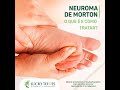 Neuroma de morton