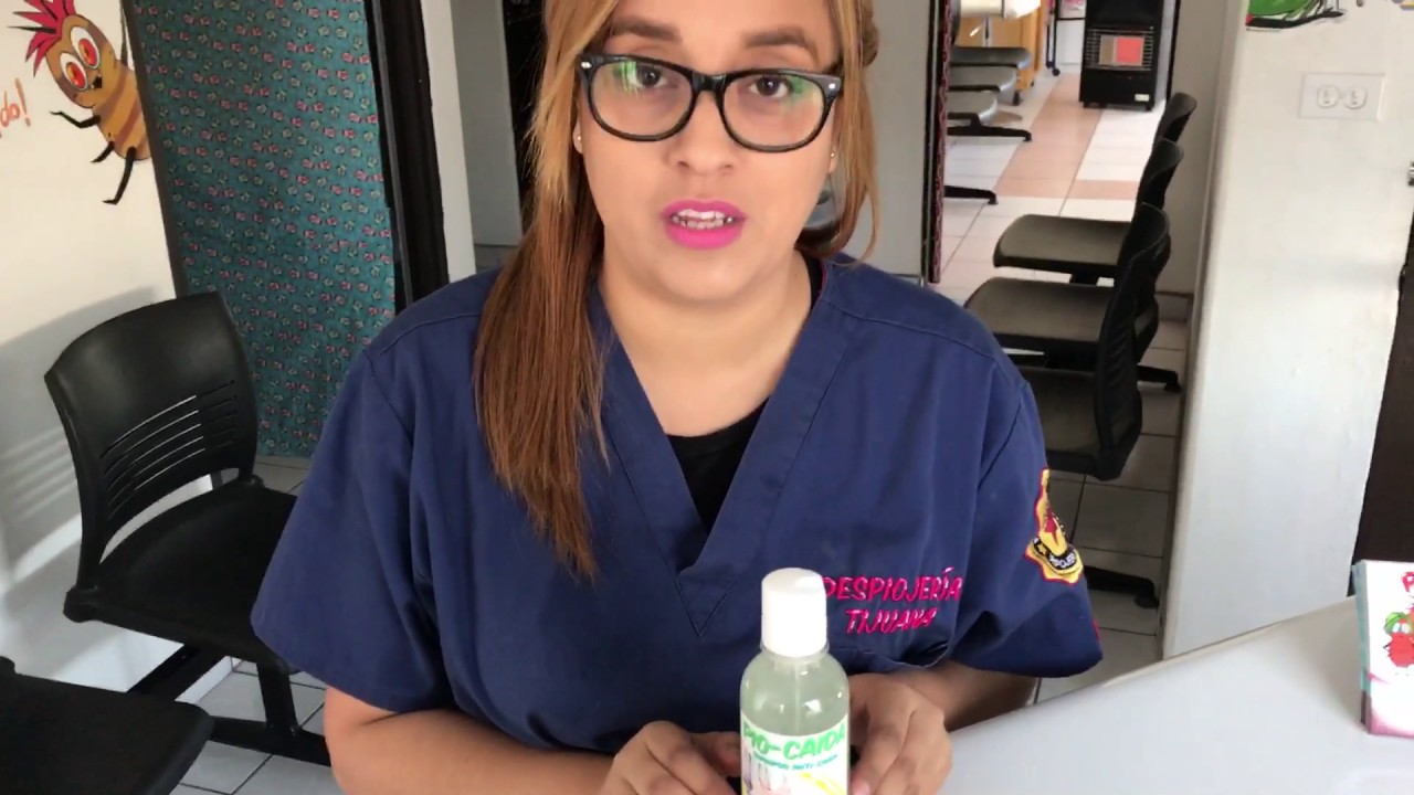 liendres como matarlas Shampoo V 51
