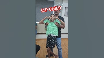 C.P child treatment by world famous Chiropractor Dr.Rajneesh kant