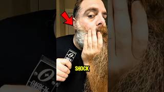 He Shaved 10 Years of Beard… They Didn’t Recognize Him 😱 Profile