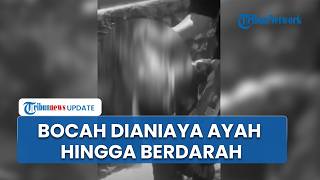 Viral Video Bocah 5 Tahun Dianiaya hingga Berdarah di Bandung Barat oleh Ayah, Pelaku Dibekuk Polisi