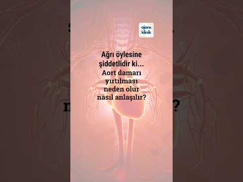 Aort damarı nedir, aort damarı yırtılması neden olur, nasıl anlaşılır?