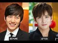 Kdrama actors before& after plastic surgery
