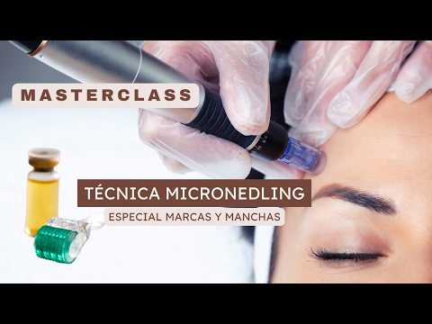 Masterclass especial manchas y marcas (técnica microneedling)