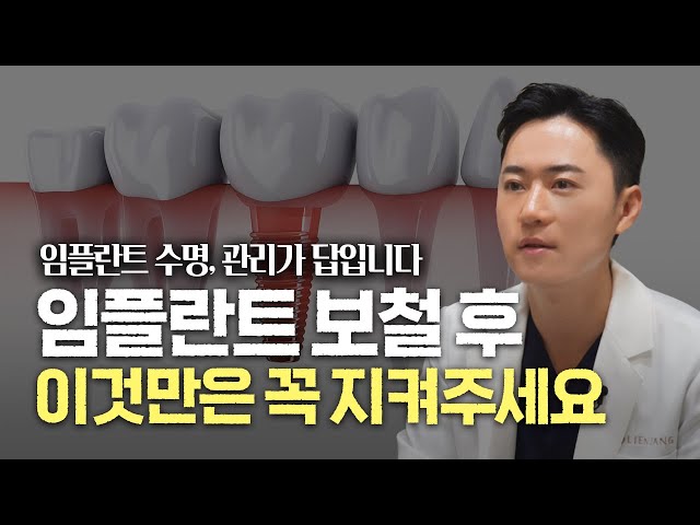임플란트 수명? 관리에 달려 있습니다