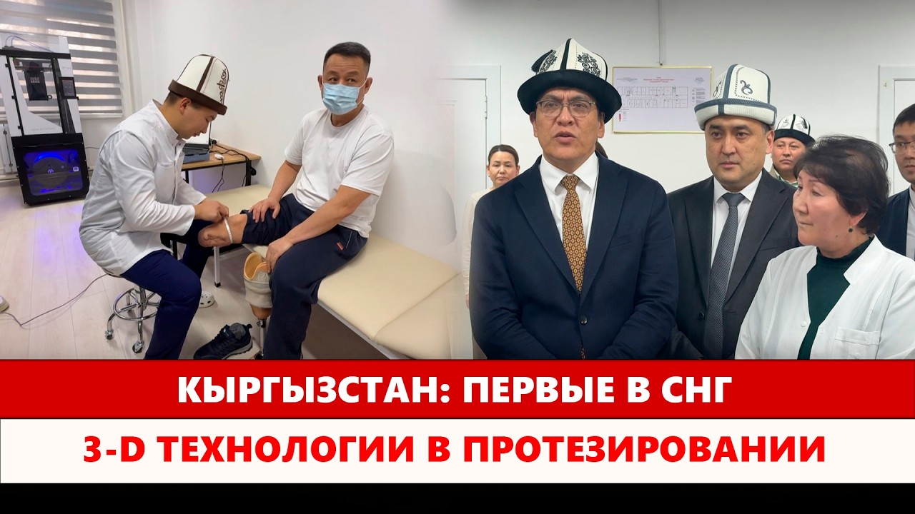 Кыргызстан: Первые в СНГ 3-D технологии в протезировании