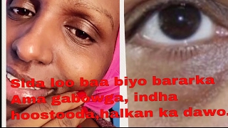 Maske Kaa Baa Bi Inayo Bararka Iyo Gabowga Indha Hoos Tooda.