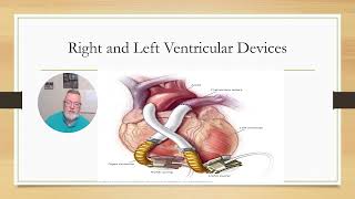 Left Ventricular Device Autosaved Autosaved