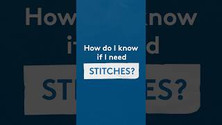 How do I know if I need stitches?