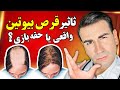 آیا مصرف قرص بیوتین واقعا از ریزش مو جلوگیری میکنه و باعث رشد مجدد مو میشه Biotin And Hair Loss mp3