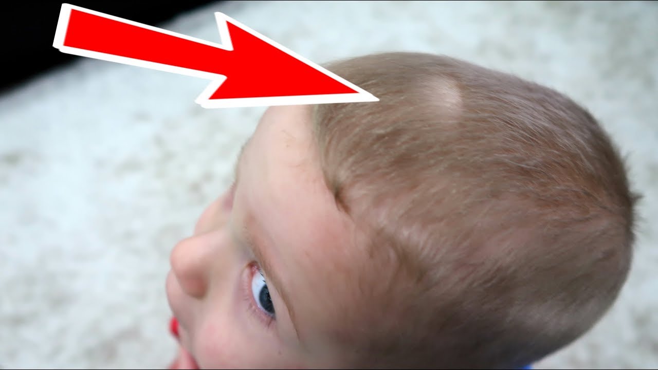 Cine i-a TAIAT PARUL lui Andries?