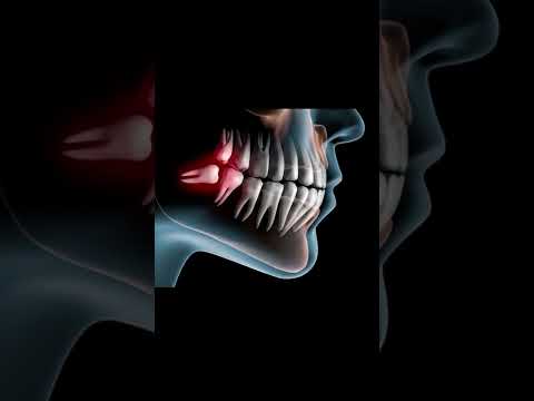 Почему зуб мудрости так называется?