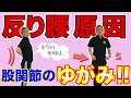 【反り腰の原因】整体では治せない！反り腰の本当の原因は、股関節のゆがみ？！エゴスキュー体操【公式】